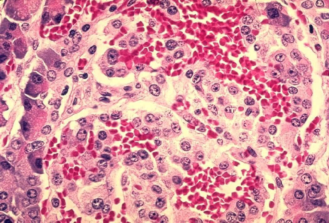 The Pancreas – What it Does & How to Keep it Healthy